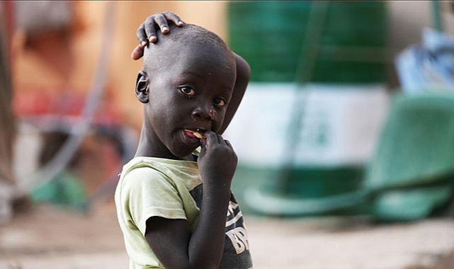 Tragedy in Darfur: Three Children Die Every Day in El-Fashir from Hunger and Disease